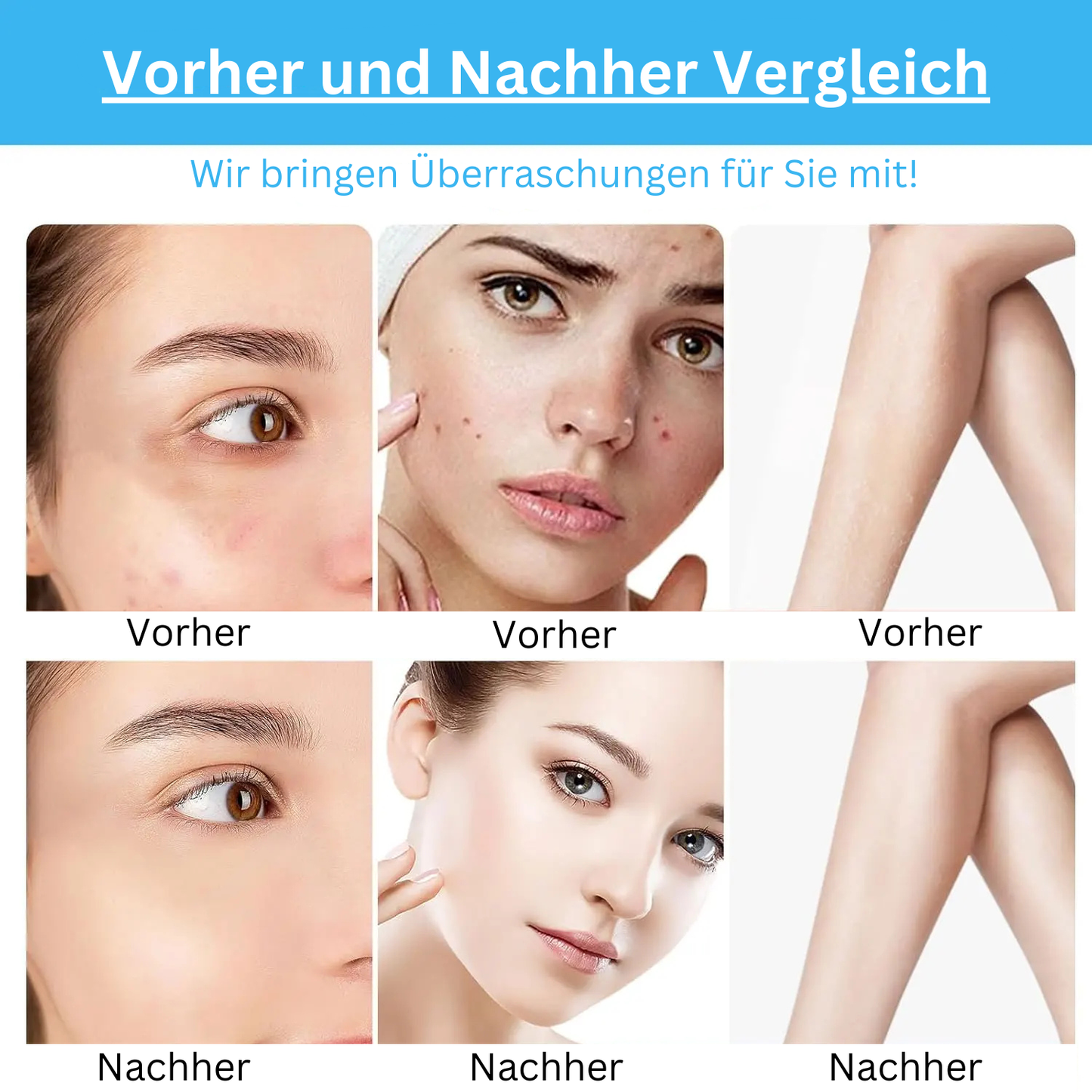 HyperPulse Zauberstab 🔌– Für glatte, verjüngte Haut
