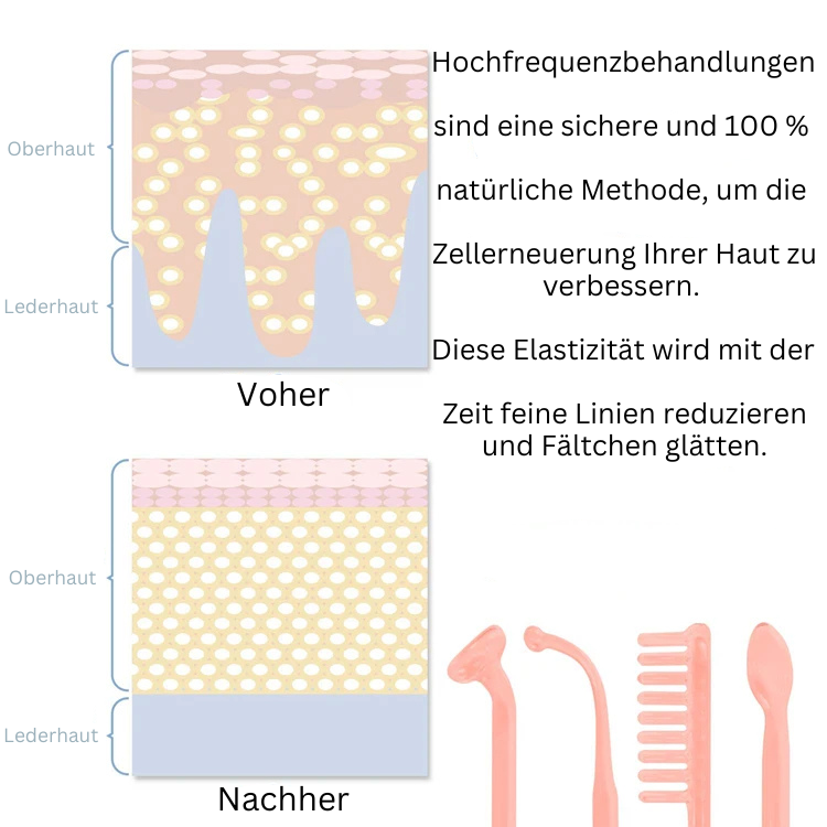 HyperPulse Zauberstab 🔌– Für glatte, verjüngte Haut